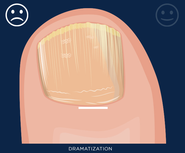 REX MD Toenail Fungus Treatment and Healthcare for Men